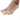 Hallux-valgus-ta-spridare